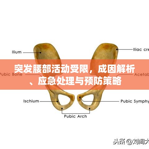 突發(fā)腰部活動受限，成因解析、應(yīng)急處理與預(yù)防策略